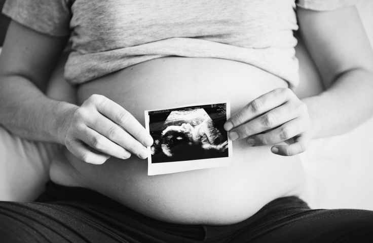 grayscale photography of woman holding ultrasound photo